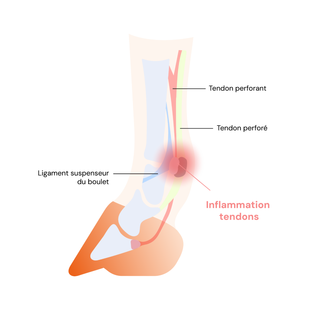 Qu’est-ce qu’un tendon ?